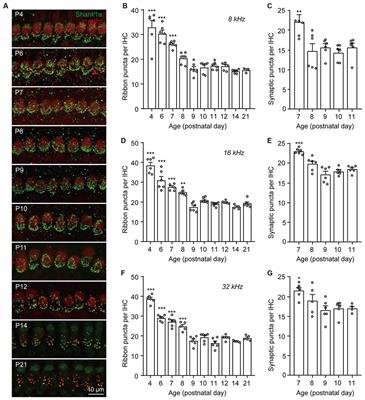 Macrophages Are Dispensable for Postnatal Pruning of the Cochlear Ribbon Synapses